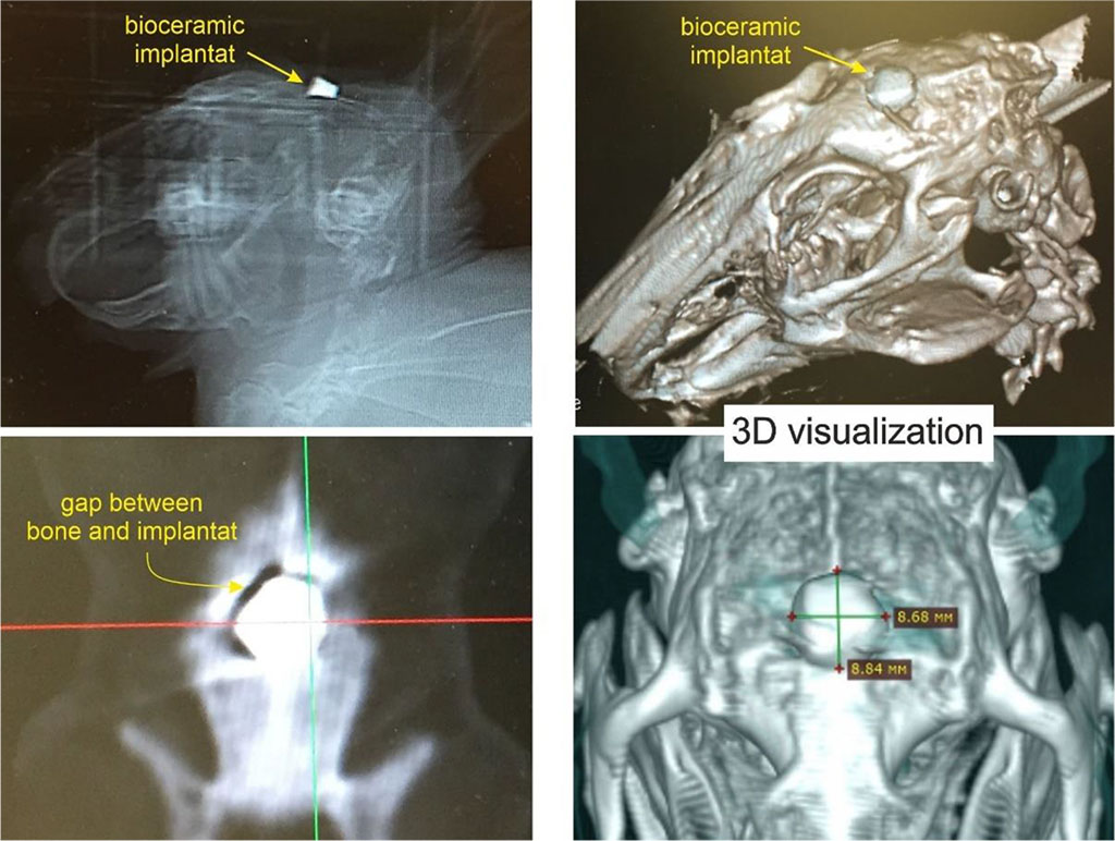 Figure 1. ZrO2-(15 wt%) HAP biocermic implant placed in a defect in the parietal bone of a rabbit. MSCT on the 3rd day after surgery.