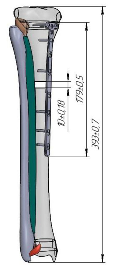 Fig.1. The solid 3D model of a shin 