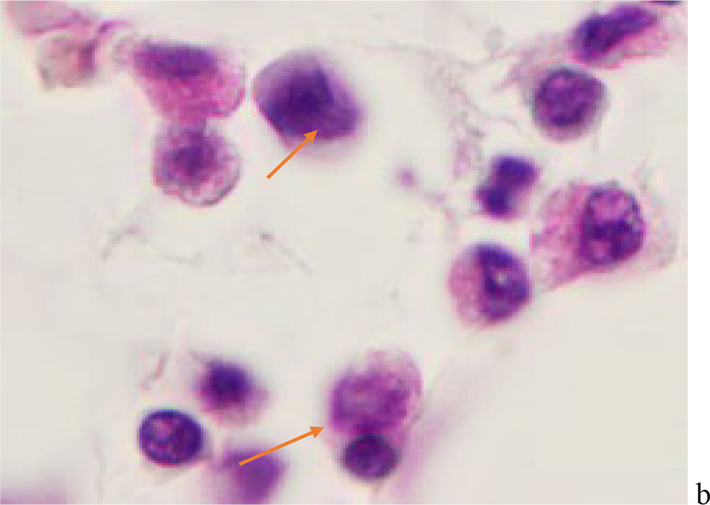 Figure 1 - Red bone marrow. Stained with hematoxylin and eosin. Magnification x 400.