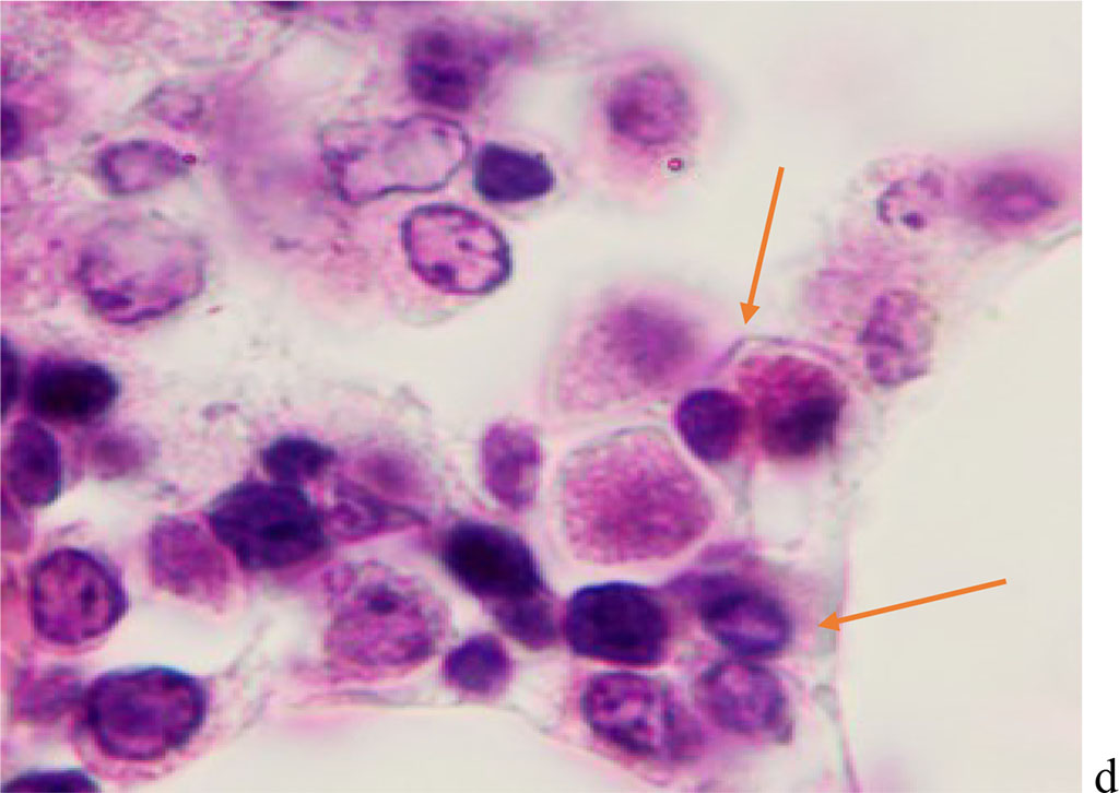 Figure 1 - Red bone marrow. Stained with hematoxylin and eosin. Magnification x 400.