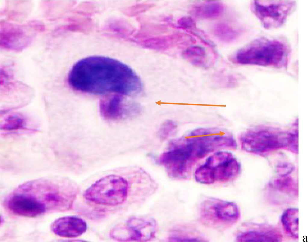 Figure 2 - Red bone marrow. Stained with hematoxylin and eosin. Magnification x 400.
