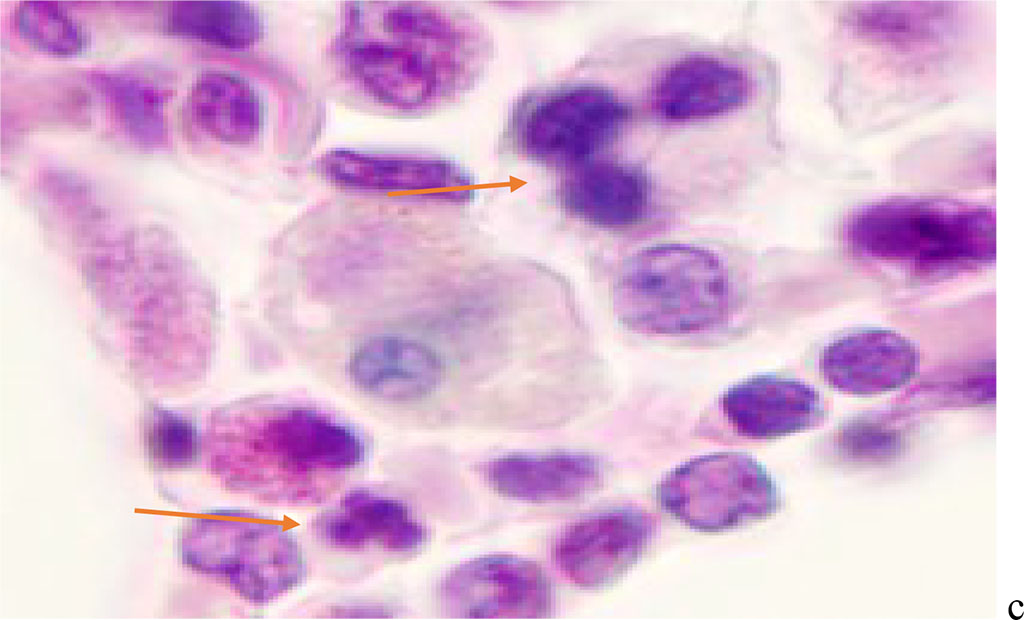 Figure 2 - Red bone marrow. Stained with hematoxylin and eosin. Magnification x 400.
