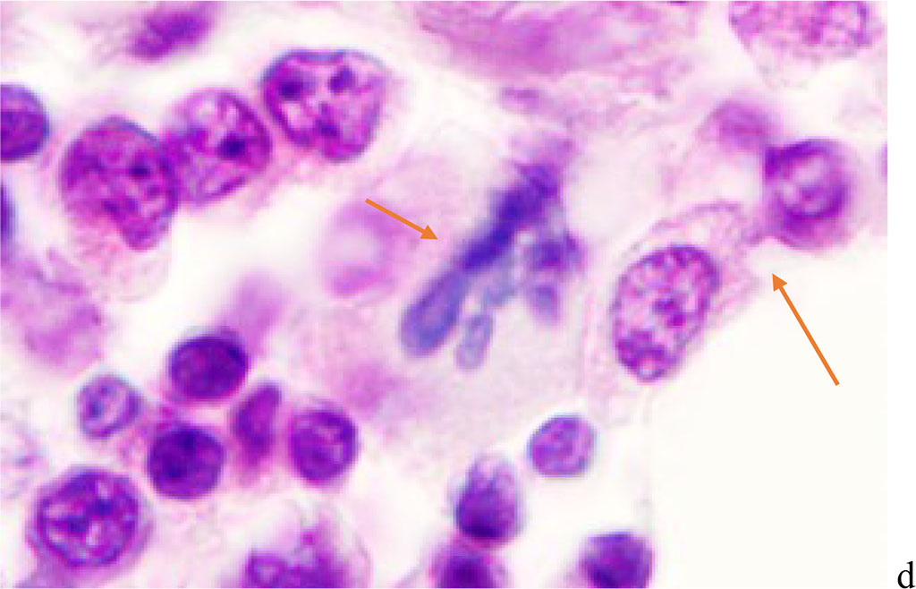 Figure 2 - Red bone marrow. Stained with hematoxylin and eosin. Magnification x 400.