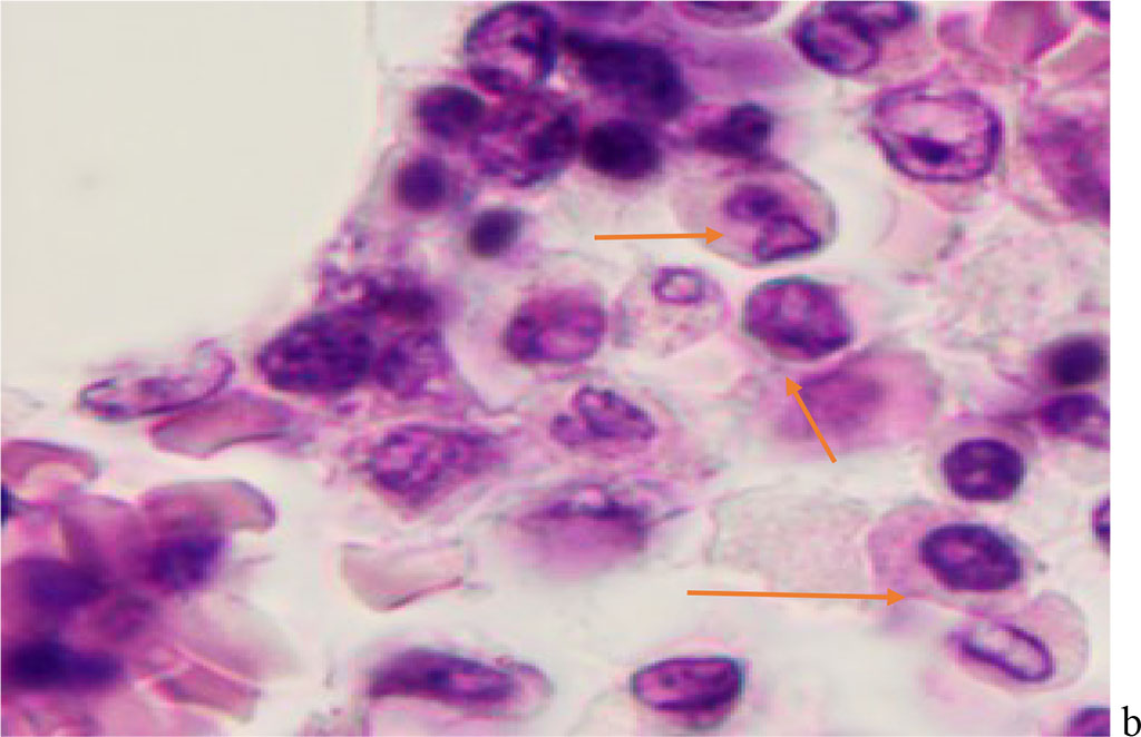 Figure 4 - Red bone marrow. Stained with hematoxylin and eosin. Magnification x 400.