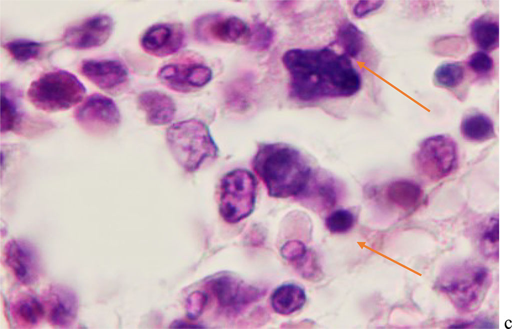 Figure 4 - Red bone marrow. Stained with hematoxylin and eosin. Magnification x 400.
