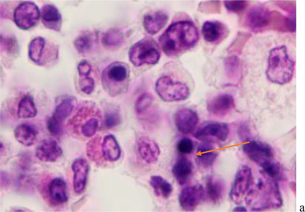 Figure 5 - Red bone marrow. Stained with hematoxylin and eosin. Magnification x 400.
