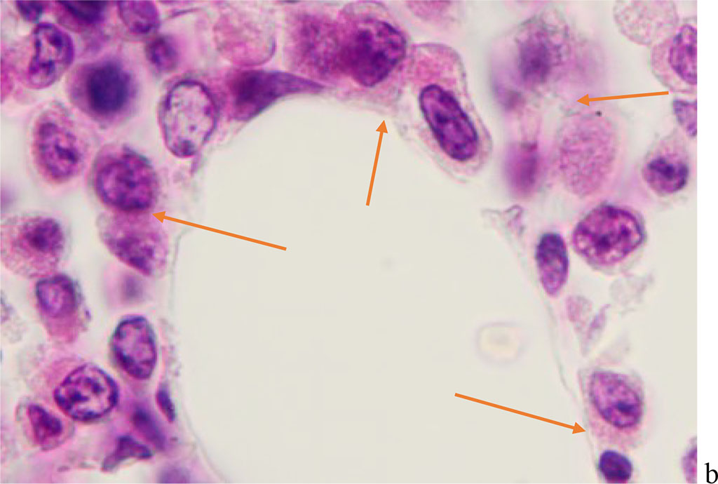 Figure 5 - Red bone marrow. Stained with hematoxylin and eosin. Magnification x 400.