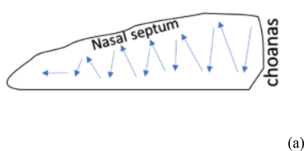 Figure 1. The result of bulbectomy in rats (yellow arrows indicate the sites of bulbectomy) (a) scheme of septoplasty simulation (b). The blue arrows indicate the direction of scarification of the nasal septum mucosa.