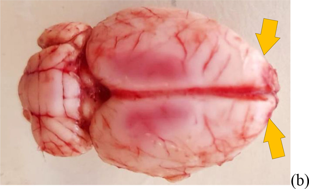 Figure 1. The result of bulbectomy in rats (yellow arrows indicate the sites of bulbectomy) (a) scheme of septoplasty simulation (b). The blue arrows indicate the direction of scarification of the nasal septum mucosa.