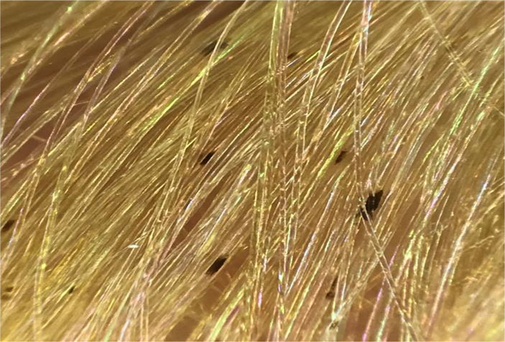 Fig. 1 Hair of patient O. suffering from black piedra