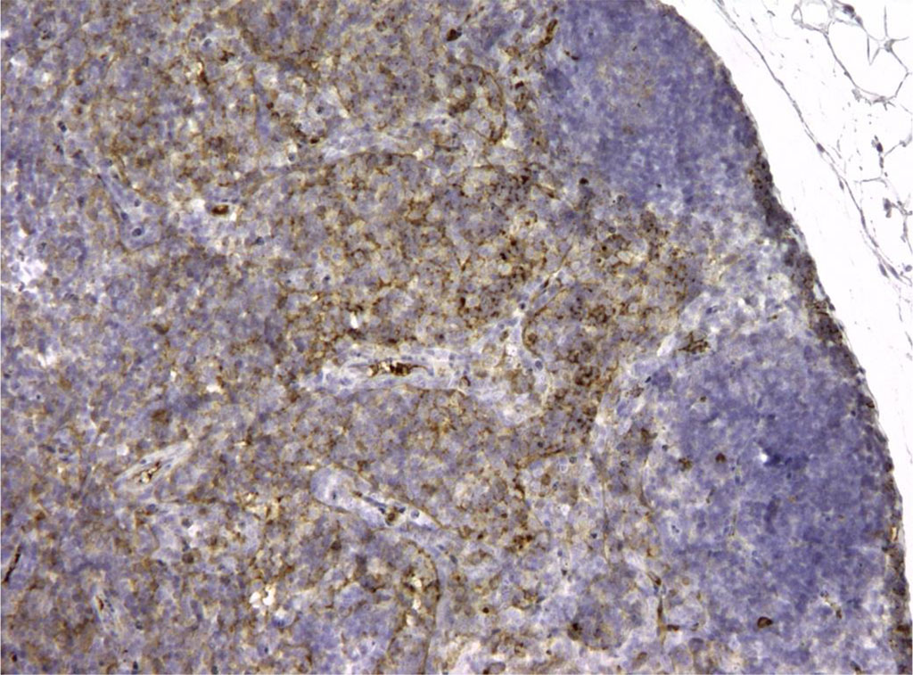 Figure 5. Rat lymph node. Morphological picture of the 3rd day of intramuscular administration of APG. In the “light centers” there are single CD3+ elements, that is, not fully differentiated lymphocytes. X100 