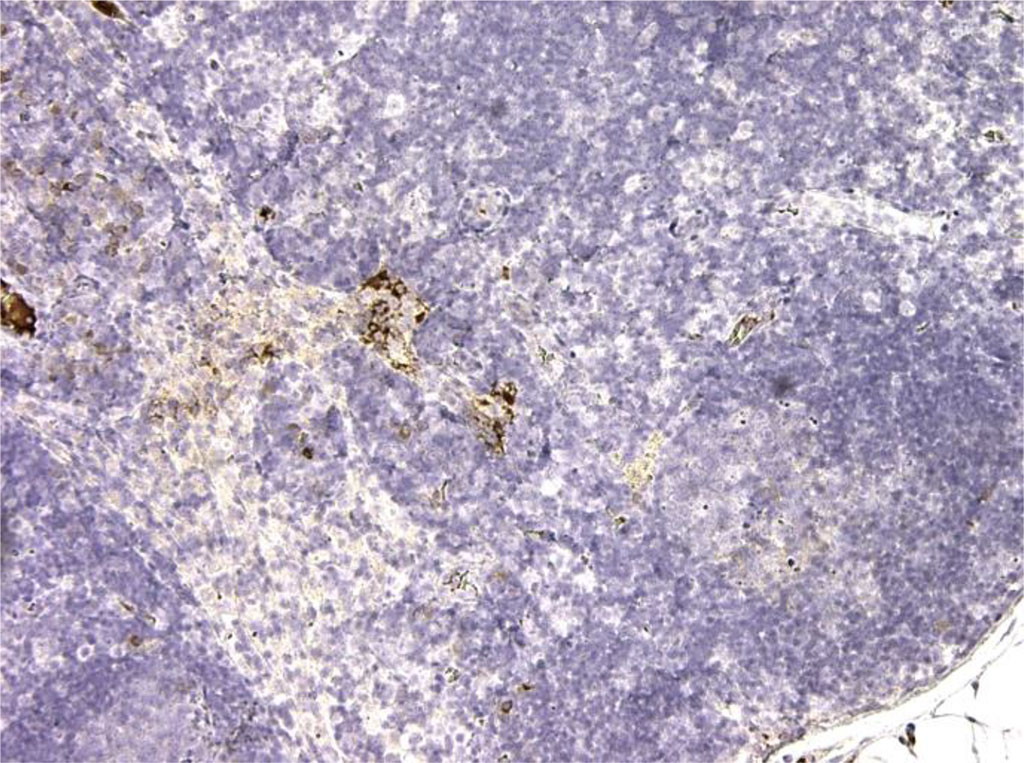 Figure 8. Rat lymph node. 7th day of intralymphatic administration of APG. CD3+ is observed in all T cells of the medulla and cortex. About 90% of cells. X100 