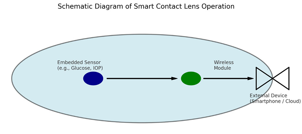 Figure 1 Schematic Diagram Of Smart Contact Lens Operation