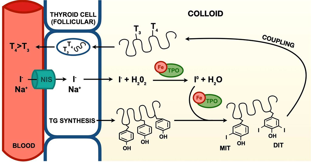Figure 1. Process of the synthesis of the thyroid hormones in the thyroid gland. Iron deficiency reduces thyroid peroxidase (TPO) activity. NIS - sodium/iodide cotransporter, MIT - monoiodotyrosine, DIT - diiodotyrosine [14,51].