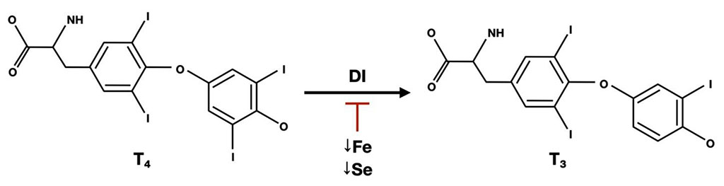 Figure 2. Impact of iron and selenium deficiency on the process of peripheral conversion in the human body cells. DI - deiodinase [14,23]
