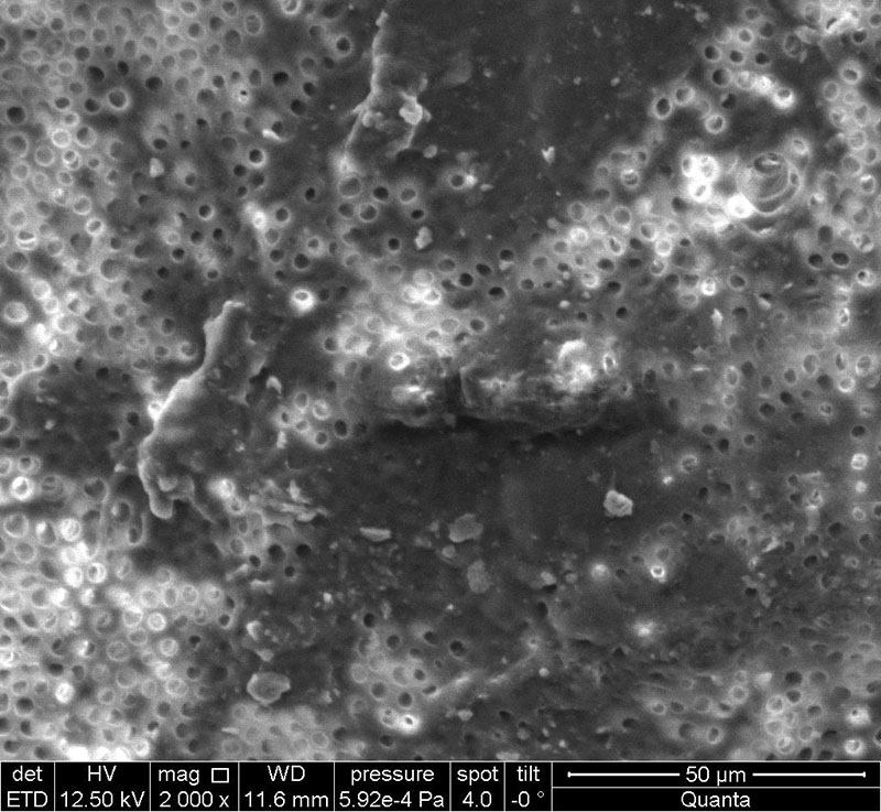 Fig. 7. No smear layer in dentinal tubules. Electronic micrograph (×2000).