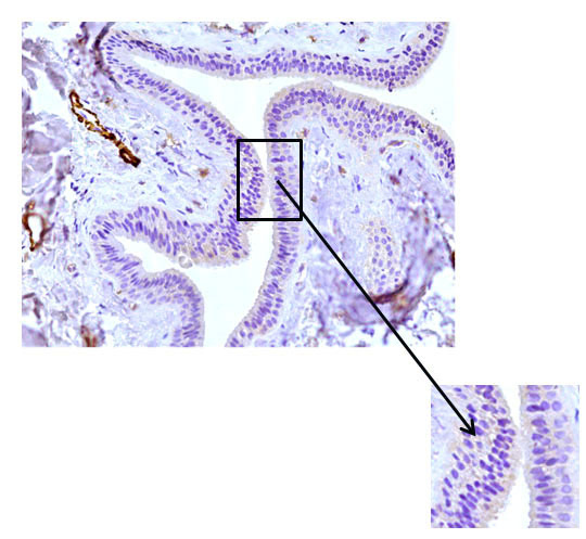 Fig. 7 The excretory duct of the salivary gland. Indirect immunoperoxidase method with antibodies to HHF35, x 200. Lack of expression in the cells of the excretory duct wall.