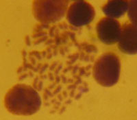 Figure 3. Cytogenetic disturbances detected on day 30 after incorporation of Tc (Group II) with activity of 15.78 mCi (polyploid cell (a), deletion (b), fragment (c)).