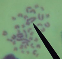 Figure 3. Cytogenetic disturbances detected on day 30 after incorporation of Tc (Group II) with activity of 15.78 mCi (polyploid cell (a), deletion (b), fragment (c)).