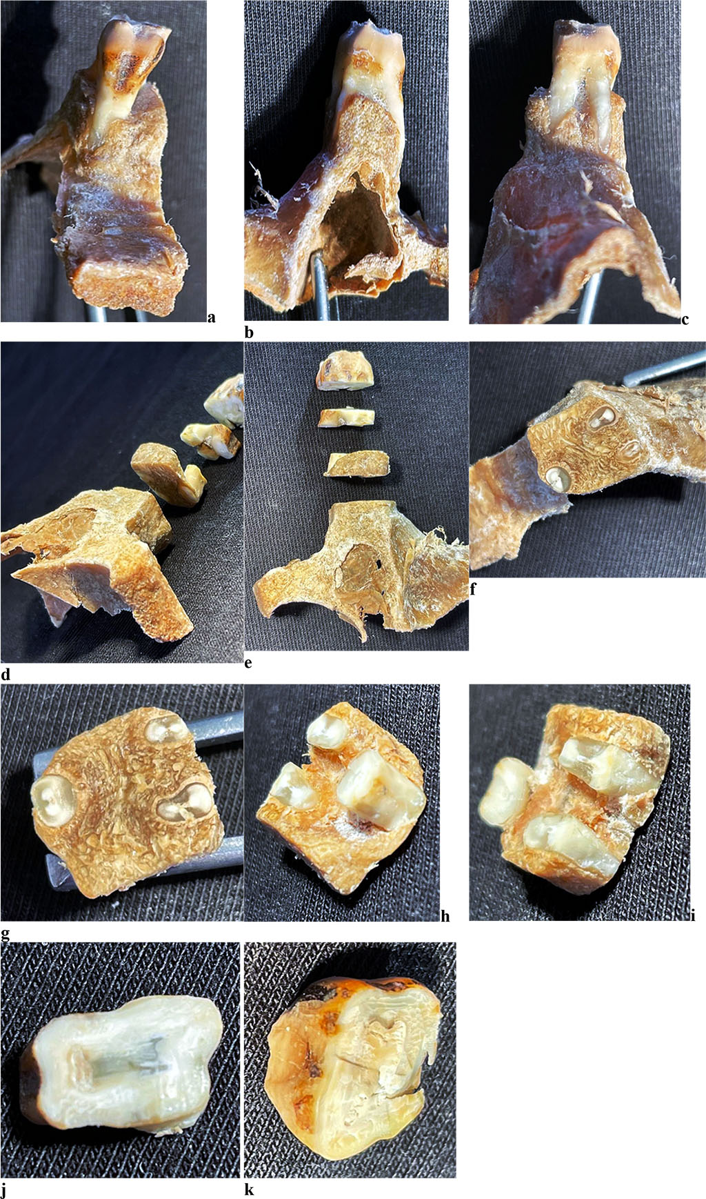 Figure 10. Maxillary segment of the maxillary first molar with periodontal ligament study areas: maxillary segment from oral surface (a), medial surface (b), distal surface (c); d, e - general view of maxillary segment; f, g - apical part of maxillary segment; h, i - middle part of maxillary segment; j - gingival part of maxillary segment; k - crown of tooth.