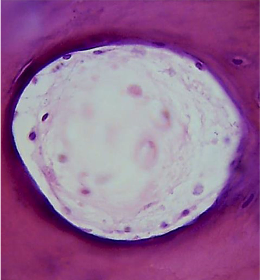 Figure 13. Morphological presentation of the maxillary alveolar process artery in the projection of the 21st tooth with preserved dentition (×800, hematoxylin-eosin stain).