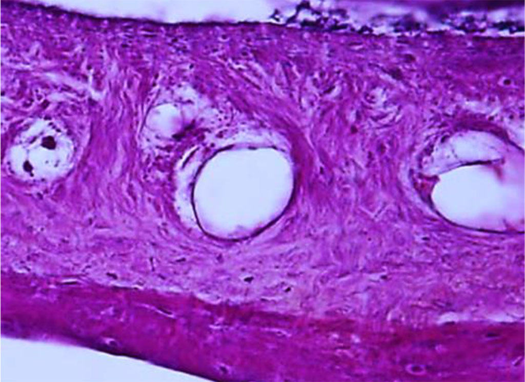 Figure 17. Periodontal ligament of the dentoalveolar segment of the maxillary medial incisor. Multiple anastomoses between arterial and venous vessels (×400, hematoxylin-eosin stain).
