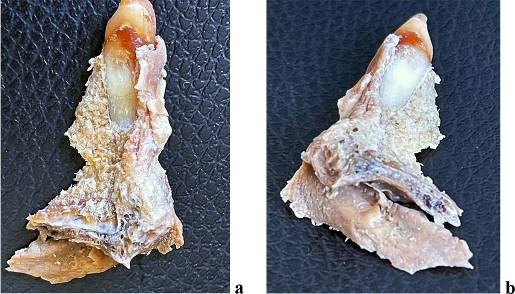Figure 3. The dentition segment of the medial incisor of the maxilla: a - medial surface; b - distal surface.