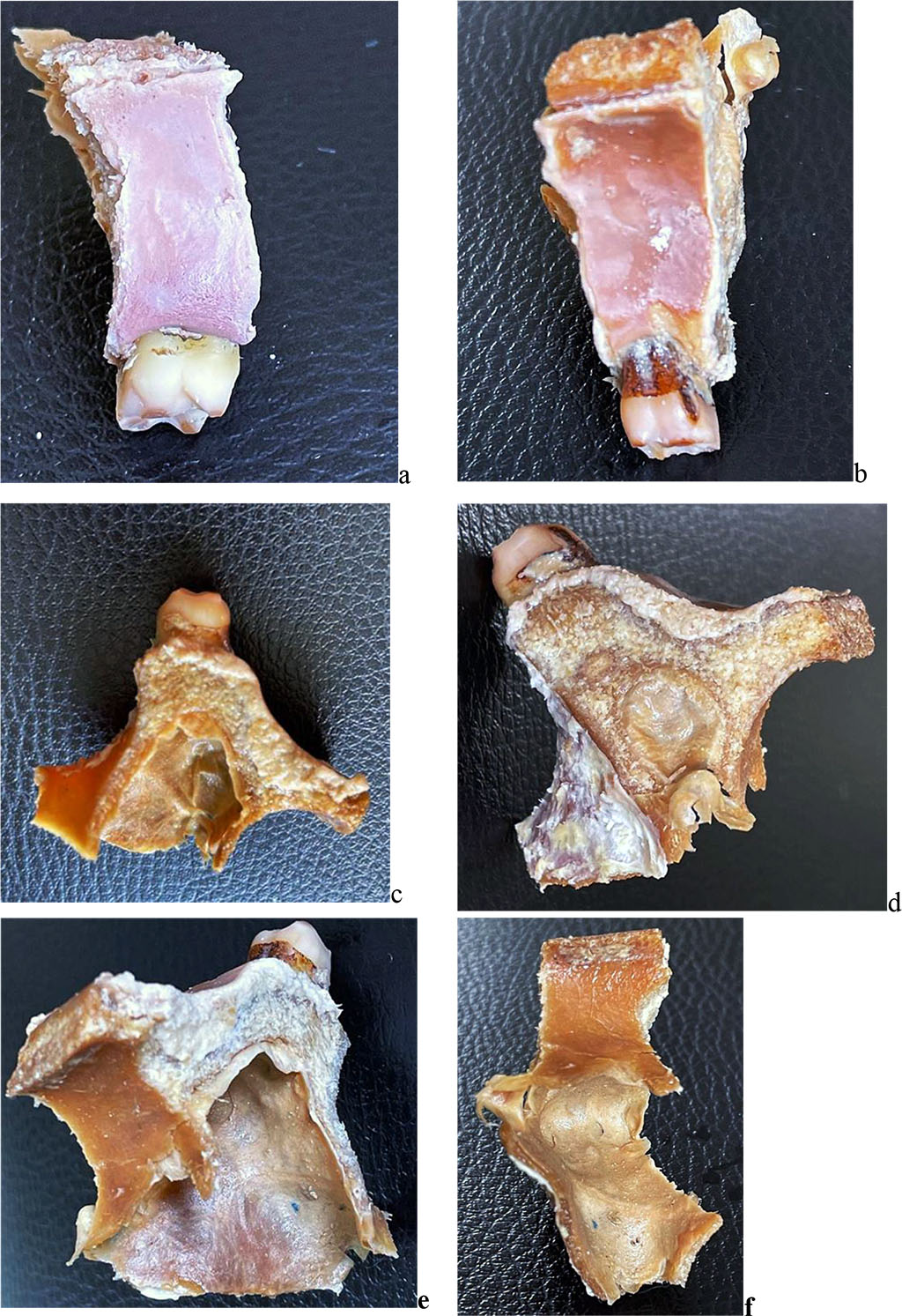 Figure 4. Maxillary segment of the maxillary first molar: a - vestibular surface; b - oral surface; c - medial surface; d - distal surface; e, f - projection from the maxillary sinus side.