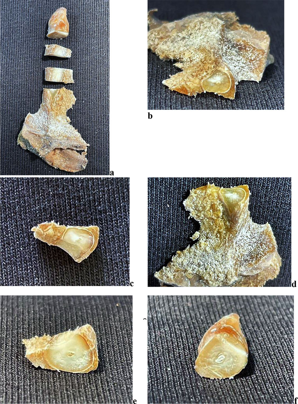 Figure 9. Maxillary segment of the maxillary central incisor with periodontal ligament study areas: a - general view of the maxillary segment; b, c - apical part of the maxillary segment; d - middle part of the maxillary segment; e - gingival part of the maxillary segment; f - crown of the tooth.