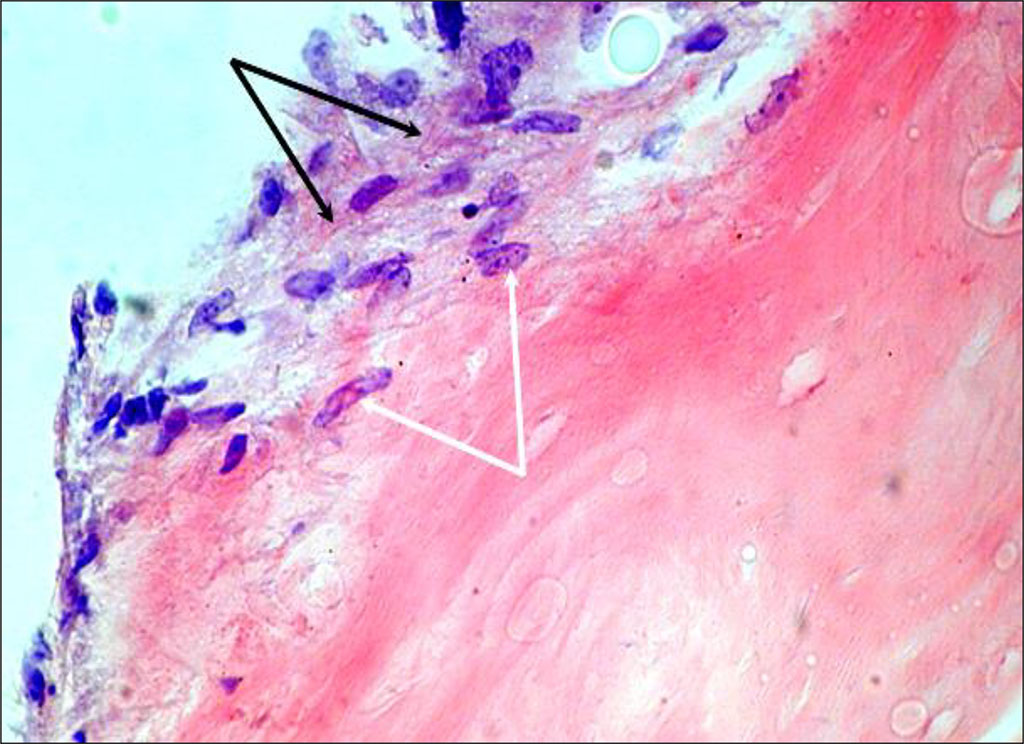 Figure 1. Cultured cells on Collapan-L. Day 7 of cultivation (staining with hematoxylin and eosin, magnification 400) – cell growth into the thickness of the carrier (white arrows) and formation of the cells’ own extracellular matrix (black arrows)