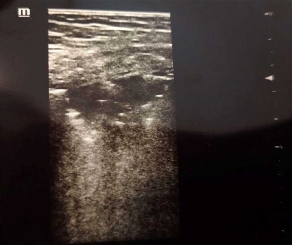 Figure 1. Consolidation. Author’s private materials.