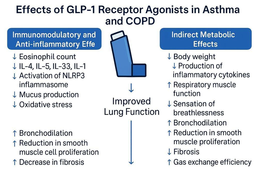 Figure 1. Effects of GLP-1 Receptor Agonists in Asthma and COPD