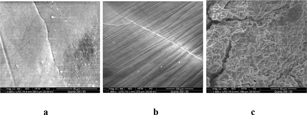 Figure 4: a. The surface of the enamel in the lesion with a wedge-shaped defect, SEM, magnification 3000; b. The surface of the enamel on the border with a wedge-shaped defect, SEM, magnification 800; c. The surface of the intact enamel on the border with the wedge-shaped defect, SEM, magnification 15000