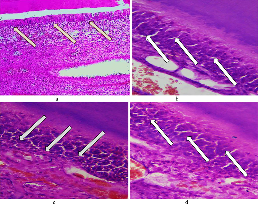 Fig. 20. Pathomorphological changes in the odontoblast layer, the main group rats, Day 32 day of the experiment: a – vacuole dystrophy of odontoblasts (×200, hematoxylin-eosin staining); b – vacuole dystrophy of odontoblasts (×8 00, hematoxylin-eosin staining); c, d – deformation and atrophy of odontoblasts (×800, hematoxylin-eosin staining).