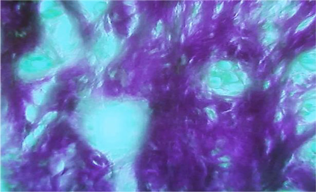 Fig. 29. Accumulation of edematous fluid between collagen fibers in the tooth pulp, the main group rats, Day 60 of the experiment (×800, Van Gieson picrofuxin staining).