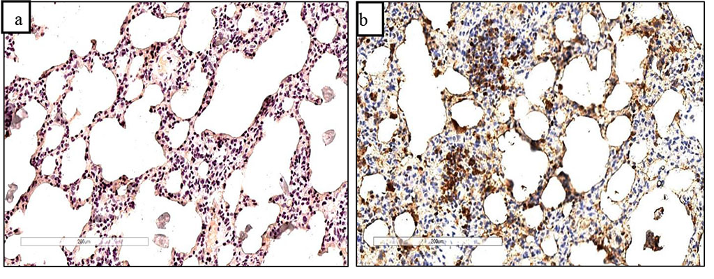 Figure 2. Faint Ki67 staining in the control group of animals (a) and immunopositive staining of Ki67 positive cells in thickened interalveolar septa after 60 days of chronic hypoxia with natural gas inhalation (b). Staining with antibodies to the Ki67 marker. Zoom. ×240.