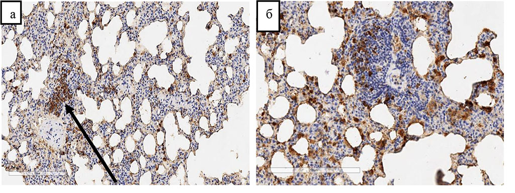 Figure 3. Release of CD68 positive cells from the vascular bed into the perivascular space (indicated by an arrow) after 60 days and an increase in the number of CD68 positive cells in the perivascular space (a) and interalveolar septa after 120 days (b) of chronic hypoxia with inhalation of natural gas. Immunohistochemical staining with antibodies to the CD68 marker. Indirect streptavidin-biotin detection system. Zoom. ×280.