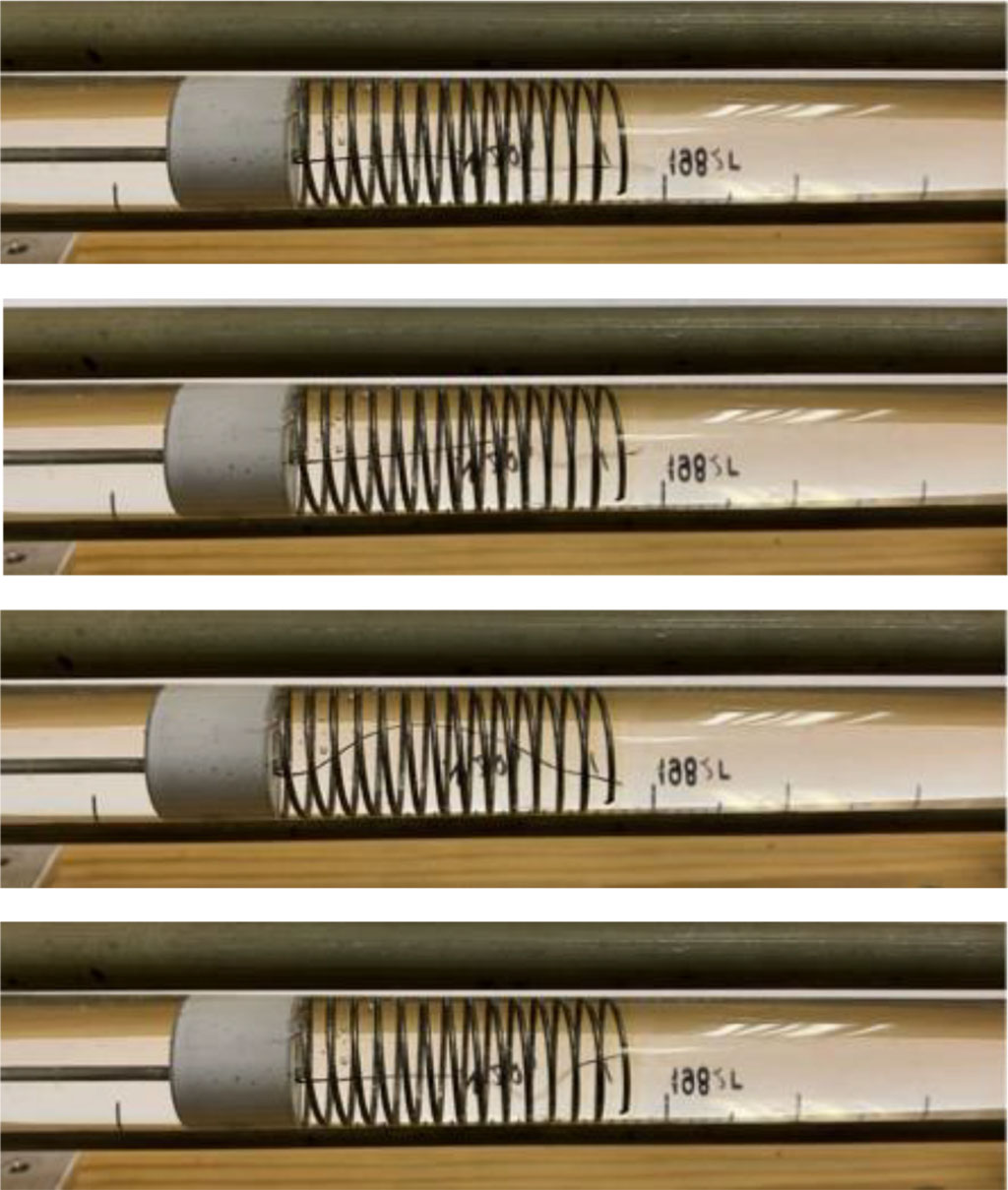 Figure 2. Intravascular stent modeling (endoprosthesis, diaphragm and silk thread are installed inside the rotameter tube). Reflected, standing waves in atrial fibrillation imitation after the pauses for 1,5 seconds and more – the indicator – thread – in different periods of time.