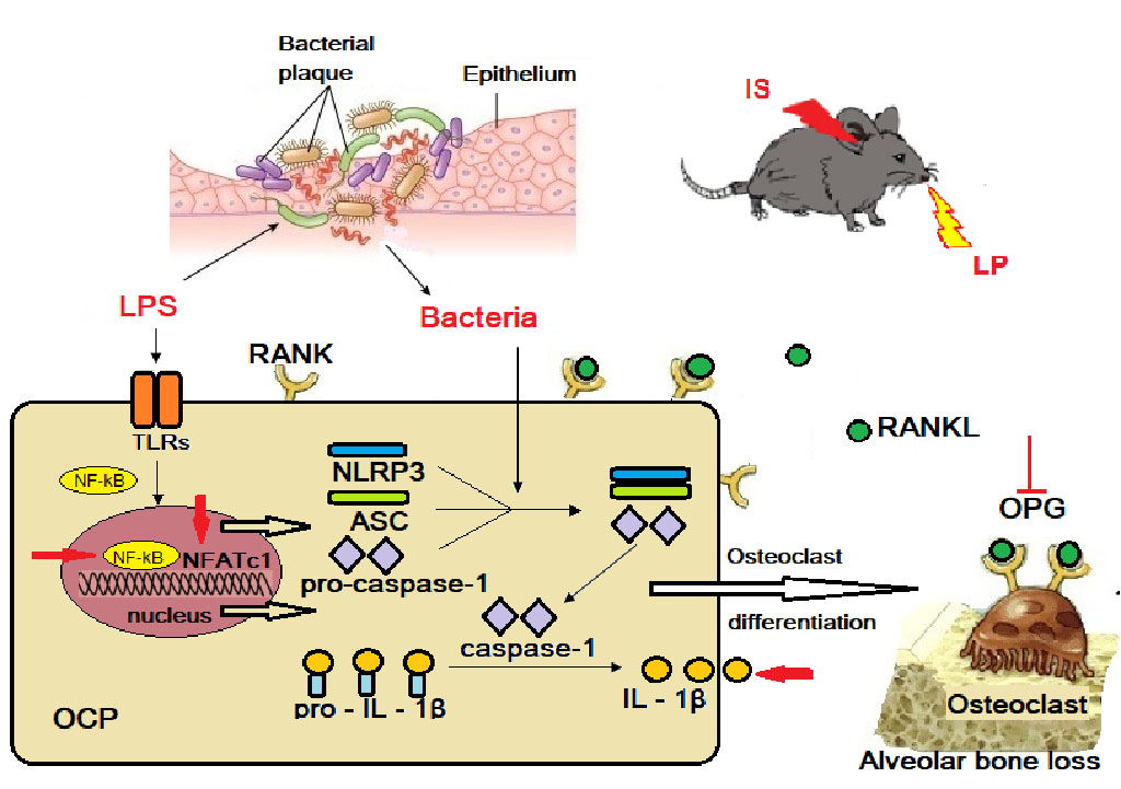 Fig. 3. Schematic diagram of NLRP3 regulating alveolar bone loss in ligature-induced periodontitis.