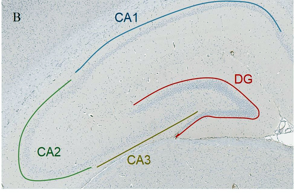 Figure 1. А. Scheme of the septoplasty simulation. Arrows indicate the direction of the nasal septum scarification. B. Location of the rat hippocampus subfields. Immunohistochemical reaction anti-p53. Staining with Mayer's hematoxylin. Magnification, х10. С. Location of the rat hippocampus subfields. Nissl staining. Magnification, х10
