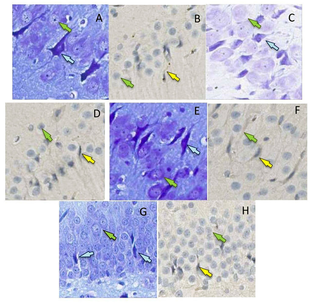 Figure 2. P53-positive neurons (b, d, f, h) (yellow arrows, surrounded by mouse monoclonal antibodies to p53 protein, x400) and dark neurons (a, c, d, g) (blue arrows, Nissl toluidine blue, x400) in the hippocampal formation in rats on the 2nd (a, b, g), 4th (c, d, h) and 6th days (e, f) after the septoplasty simulation. Green arrows indicate intact neurons. Subfield CA1 – a, d; subfield CA2 – b, c; subfield CA3 – e, f; DG – g, h.