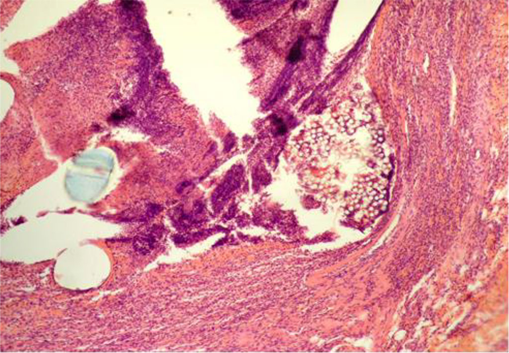 Fig. 1. AAW of the CG animal by Day 7 of the experiment. Staining with H&E. ×10
