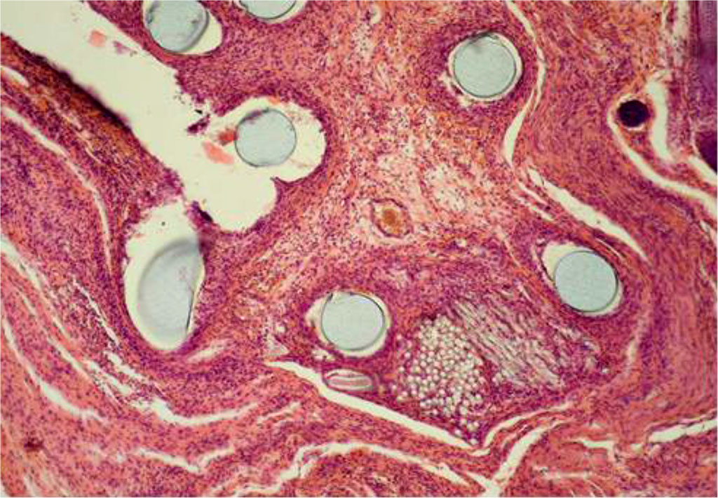 Fig. 3. AAW of the CG animal by Day 14 of the experiment. Staining with H&E. ×10 