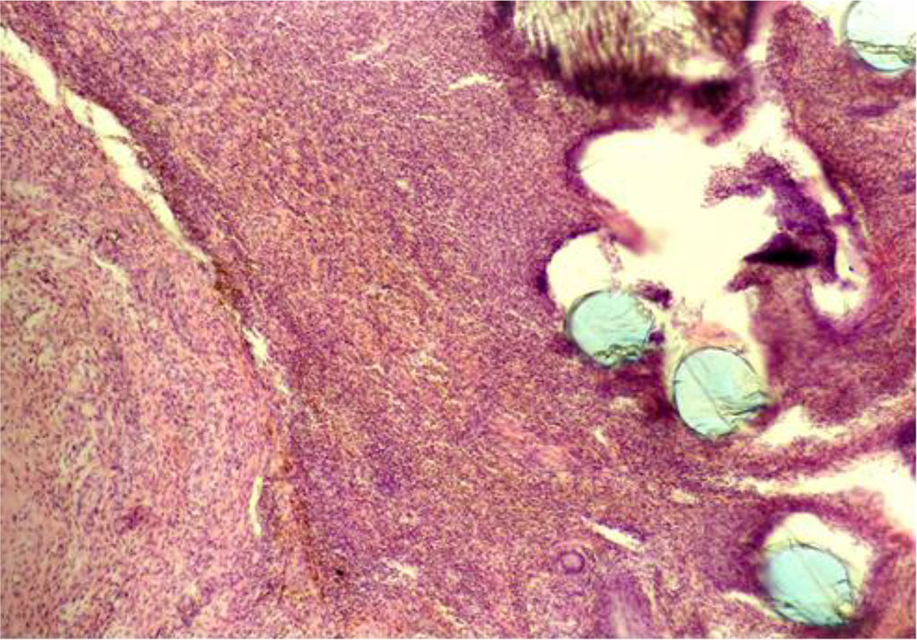 Fig. 7. The fragment of AAW of the CG animal with elements of PP-MI. Day 28 of the experiment. Staining with H&E. ×10 