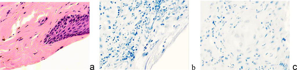 Figure 3 - Wound surface of the skin: a - wound edges, epithelialization of damage; b, c, d – infiltration of the damaged area by leukocytes. Magnification. x 100. Staining: a) with hematoxylin and eosin; b, c) hematoxylin.