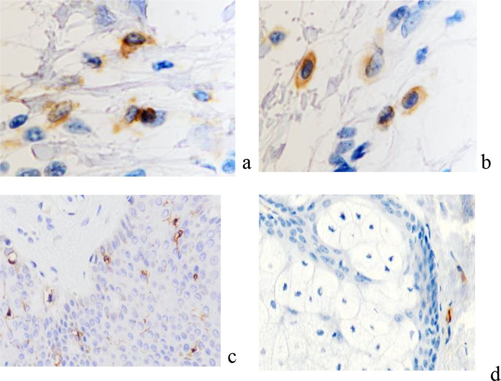 Figure 8 - Epidermis of the skin with keloid scars: a - earlobe; b – breast skin after correction. Stained with hematoxylin and eosin. Magnification x 200.