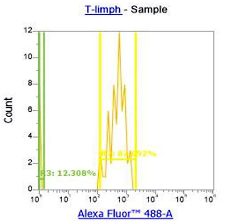 Figure 5. Separation of T-cell lymphocyte subpopulations into CD16+ (gamma/delta T-lymphocytes) and CD16- (other T-helpers).