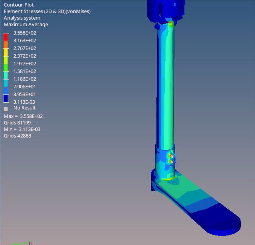 Rysunek 5. Mapa naprężenia wg. hipotezy Hubera-Mises'a-Hencky'ego (HMH) dla całej protezy