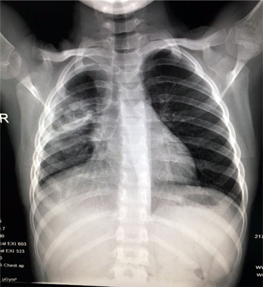 Fig. 10. Same case as in Fig 4-9 after 1 month of treatment